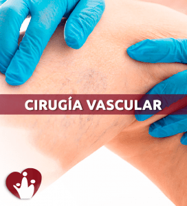 cirugia-vascular-clinica-de-especialidades-tumbaco