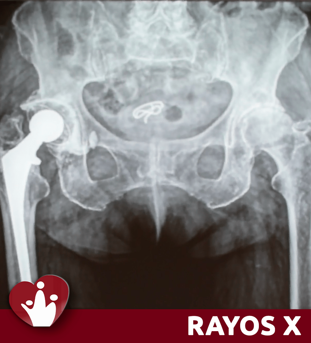 rayos-x--clinica-de-especialidades-tumbaco