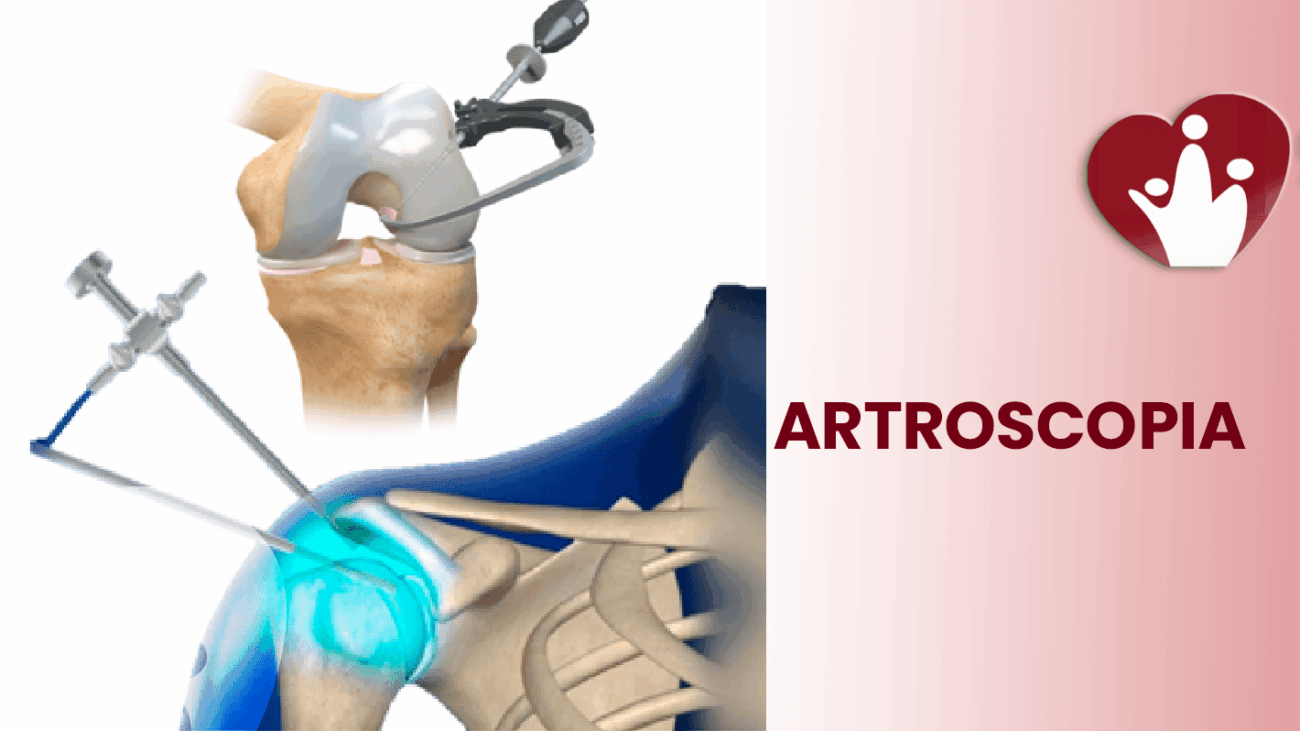 artroscopia-clinica-tumbaco