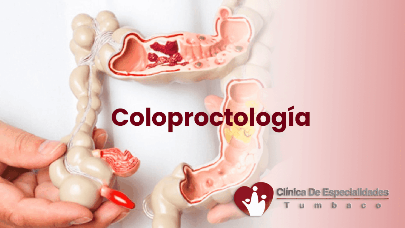 coloproctologia-en-tumbaco---colonoscopia