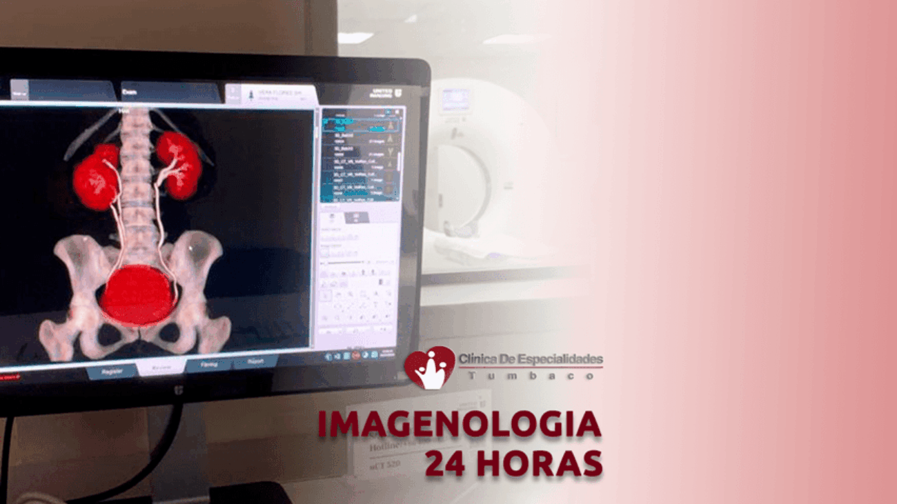 rayos-x-tomografia-ecografia-24-horas-emergencias-tumbaco