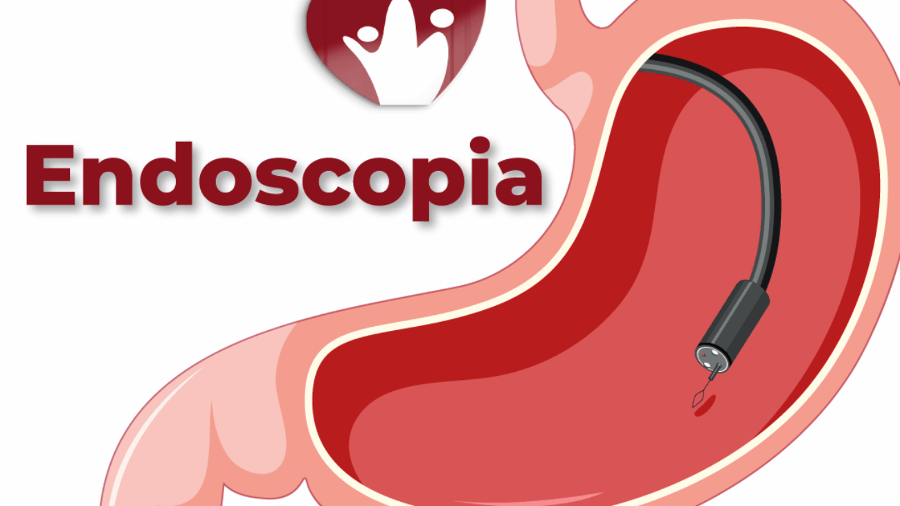 endoscopia