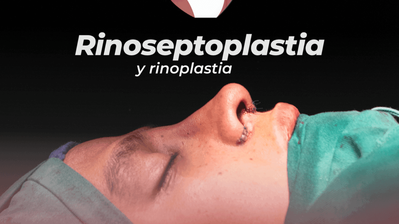 rinoseptoplastia-en-tumbaco